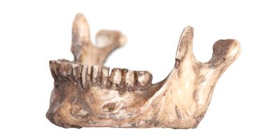 teeth-could-preserve-antibodies-hundreds-of-years-old-study-finds-s